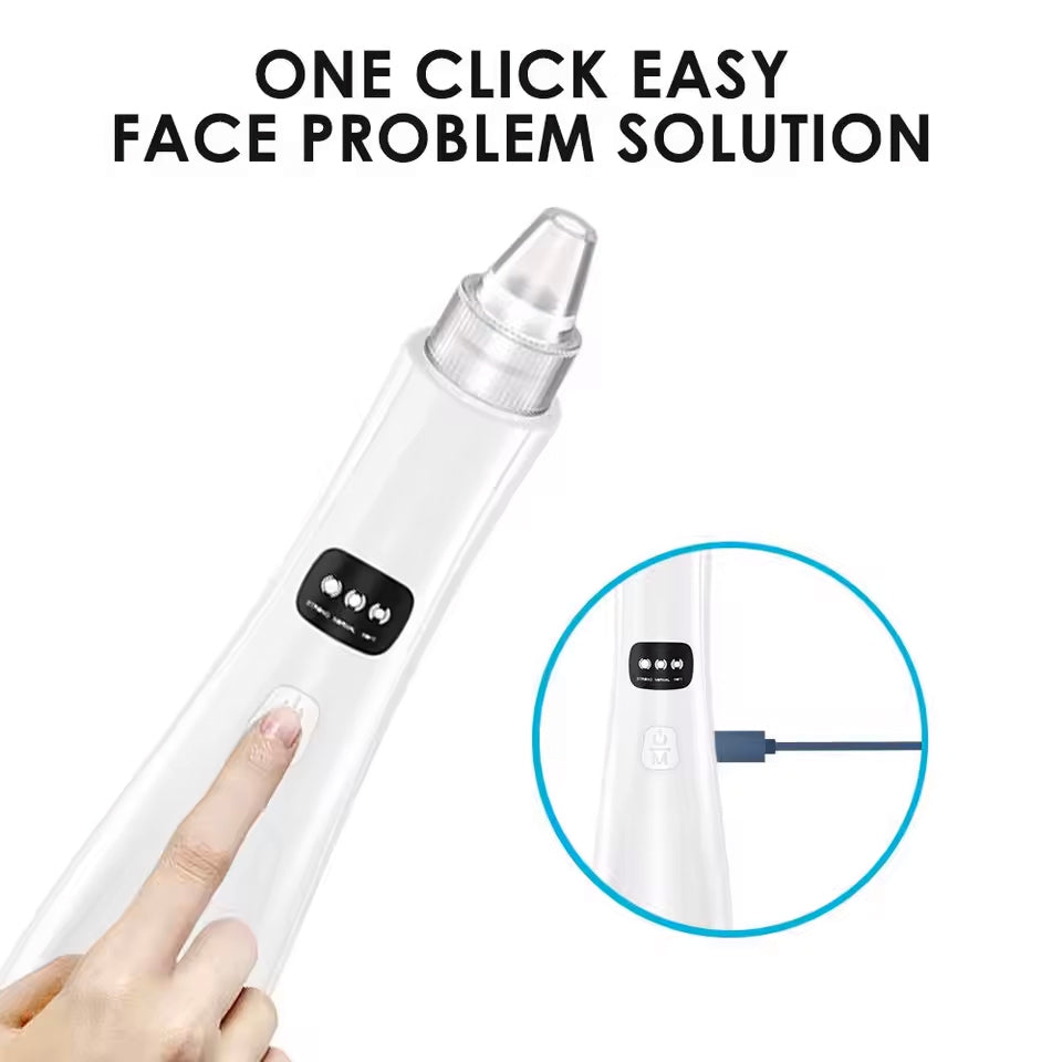 Electric Blackhead Remover