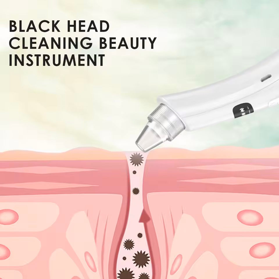 Electric Blackhead Remover