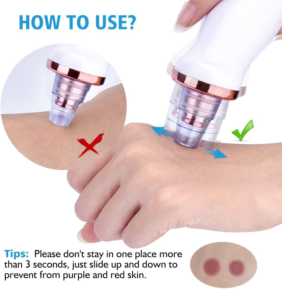 Electric Blackhead Remover