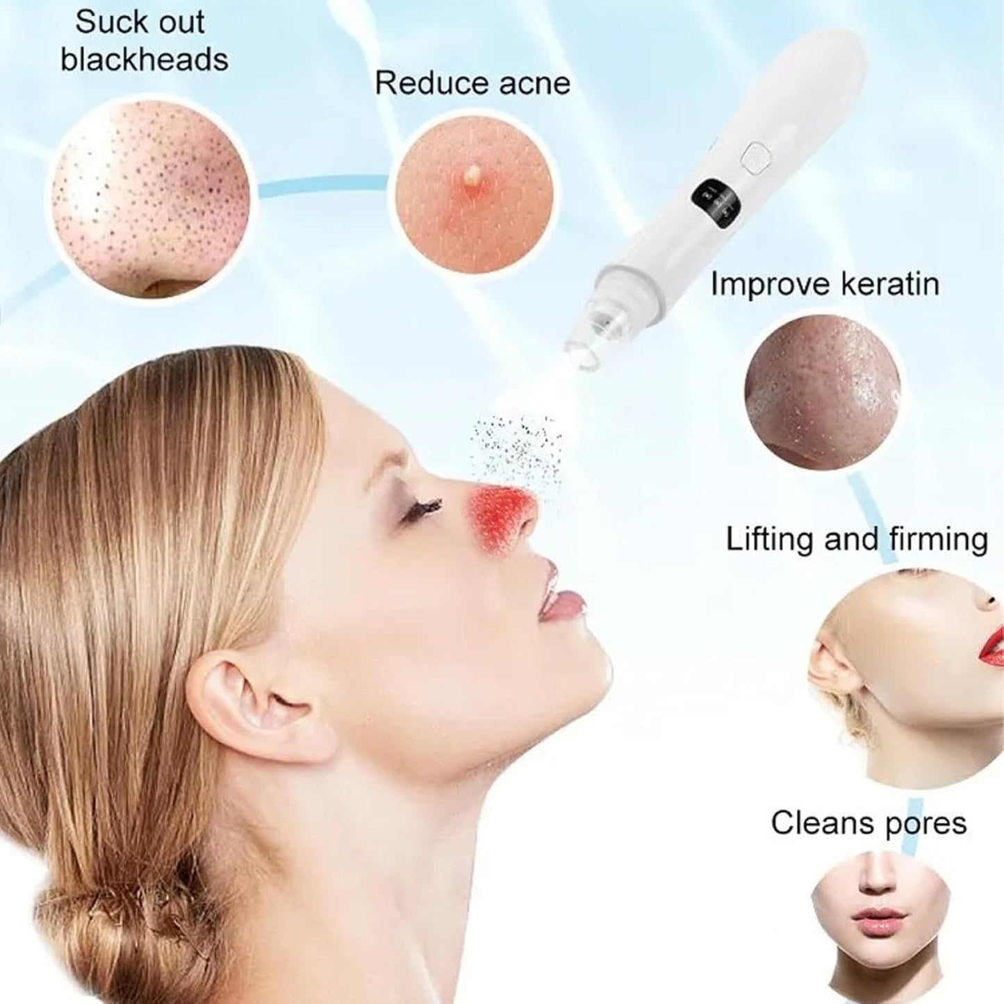 Electric Blackhead Remover