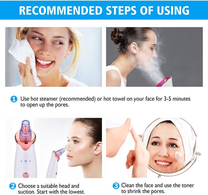 Electric Blackhead Remover